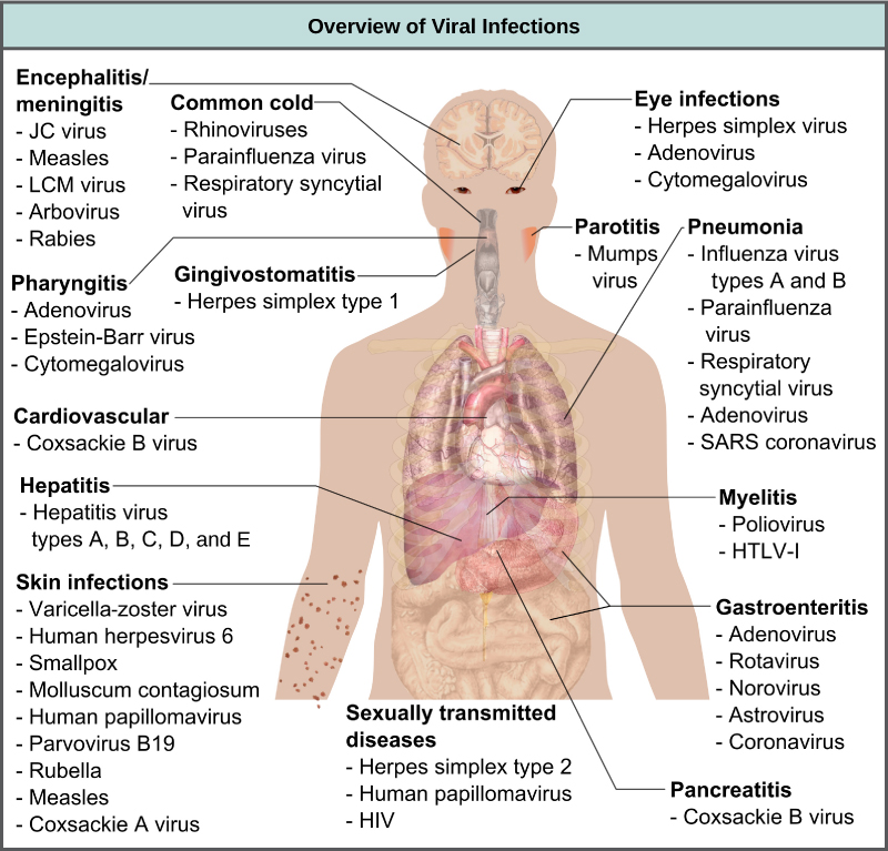 viral meningitis structure